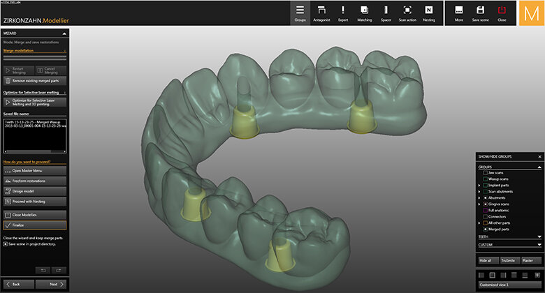 3D Bild von Zähnen